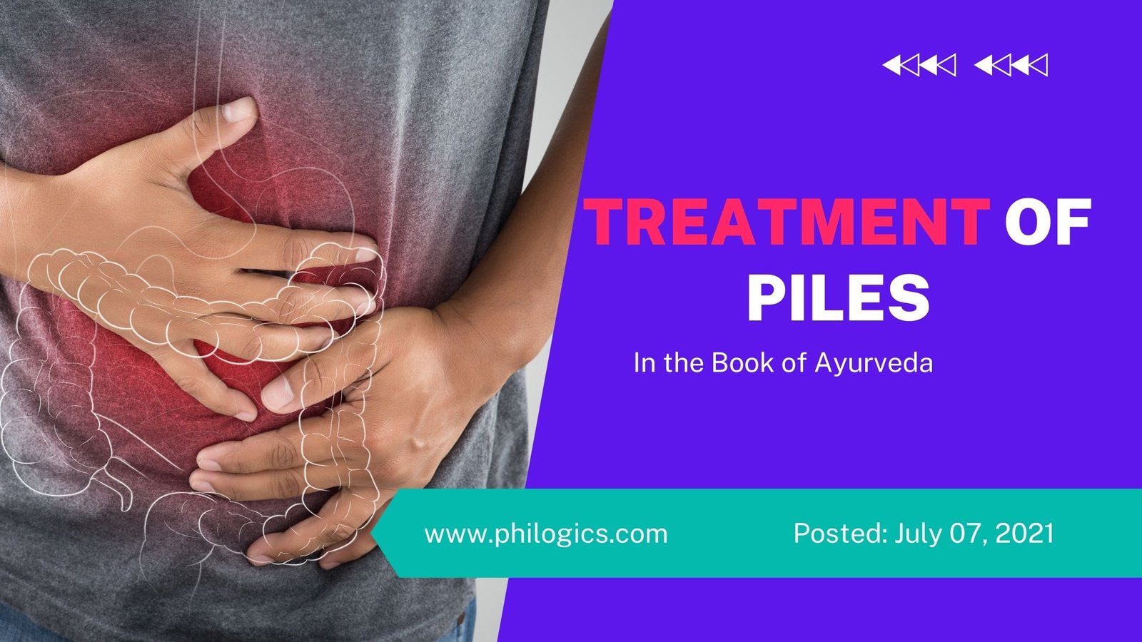 Treatment of Piles in the Book of Ayurveda